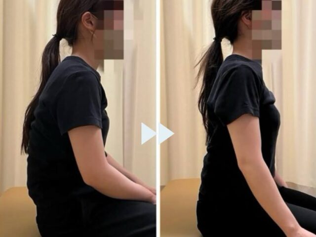 姿勢矯正での変化