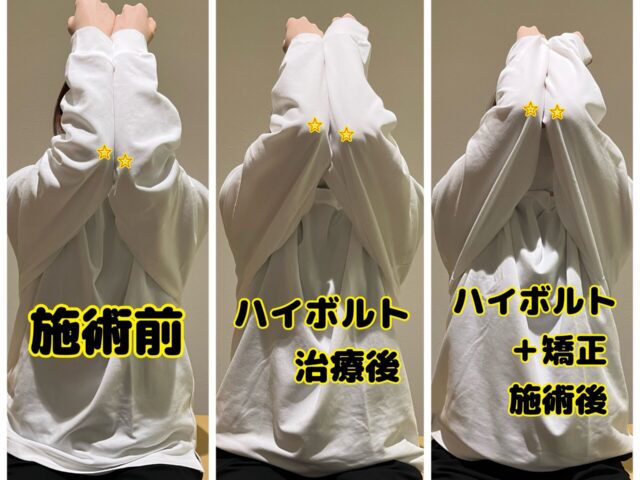 肩の動きはその場で変わることがあります