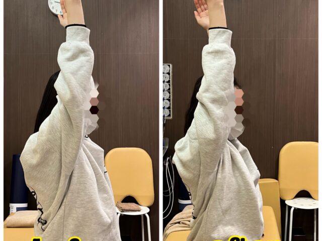 上を向くのがつらい、詰まる感覚がある方は是非ご相談ください。