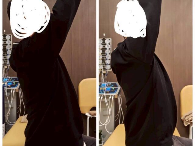 肩こりと頭痛の関係について