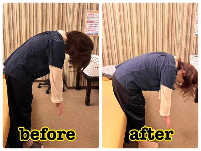 ぎっくり腰は、痛みが軽くなったら終わりでしょうか？
